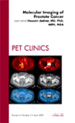 Molecular Imaging of Prostate Cancer, An Issue of PET Clinics: Volume 4-2