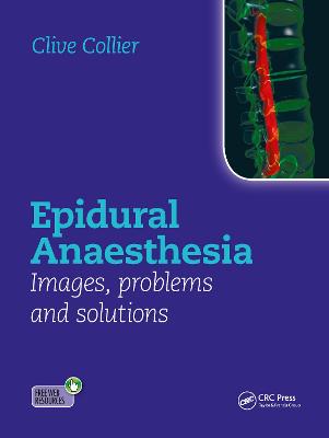 Epidural Anaesthesia: Images, Problems and Solutions
