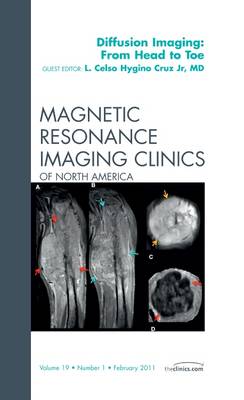 Clinical Applications of Diffusion Imaging: from Head to Toe, An Issue of Magnetic Resonance Imaging Clinics: Volume 19-1