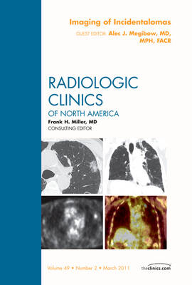 Imaging of Incidentalomas, An Issue of Radiologic Clinics of North America: Volume 49-2