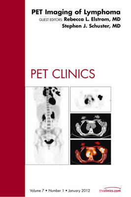 PET Imaging of Lymphoma, An Issue of PET Clinics: Volume 7-1