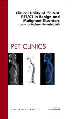 Clinical Utility of 18NaF PET/CT in Benign and Malignant Disorders, An Issue of PET Clinics: Volume 7-3