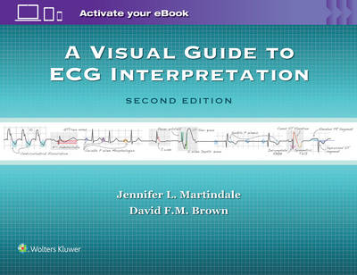 A Visual Guide to ECG Interpretation