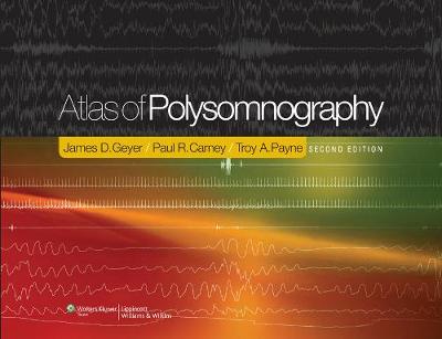 Atlas of Polysomnography 