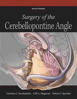 Surgery of the Cerebellopontine Angle