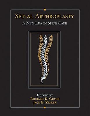Spinal Arthroplasty