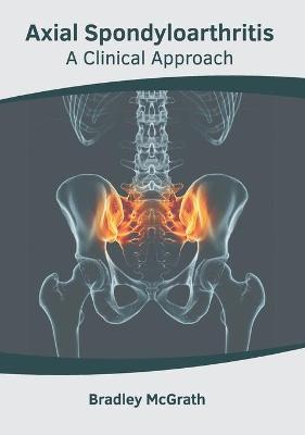 Axial Spondyloarthritis: A Clinical Approach