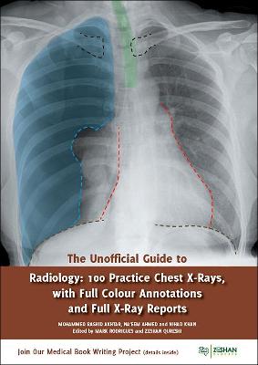 The Unofficial Guide to Radiology: 100 Practice Chest X Rays with Full Colour Annotations and Full X Ray Reports