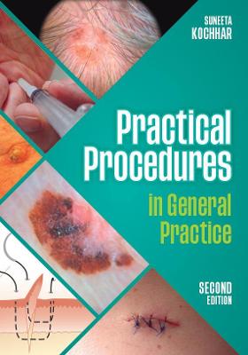 Practical Procedures in General Practice, second edition