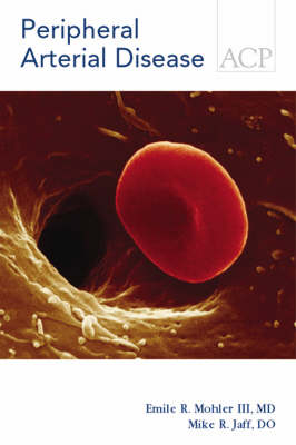 Peripheral Arterial Disease