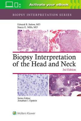 Biopsy Interpretation of the Head and Neck