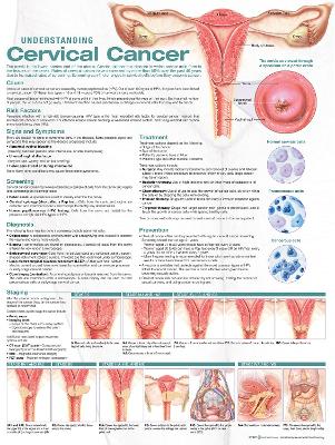 Understanding Cervical Cancer Anatomical Chart