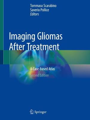 Imaging Gliomas After Treatment