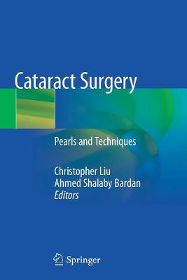 Cataract Surgery