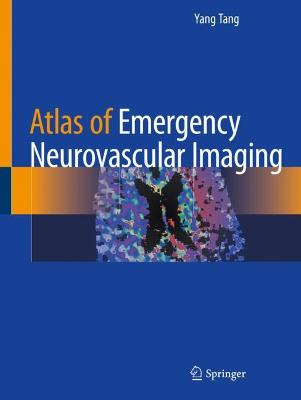 Atlas of Emergency Neurovascular Imaging