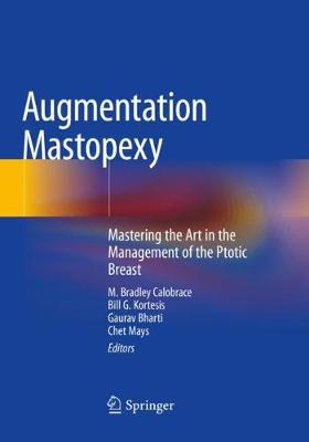 Augmentation Mastopexy