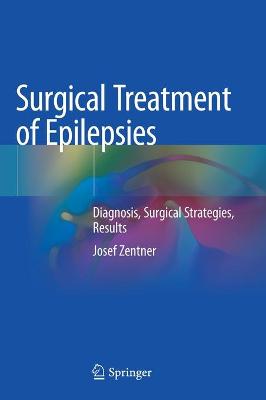 Surgical Treatment of Epilepsies