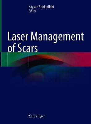 Laser Management of Scars