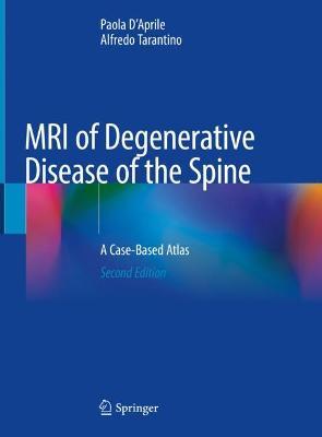 MRI of Degenerative Disease of the Spine