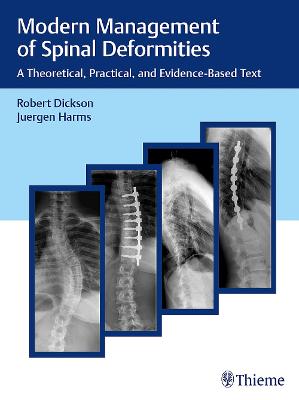 Modern Management of Spinal Deformities