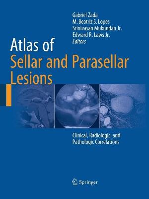 Atlas of Sellar and Parasellar Lesions