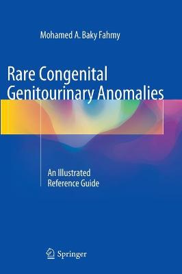 Rare Congenital Genitourinary Anomalies
