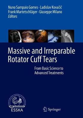 Massive and Irreparable Rotator Cuff Tears