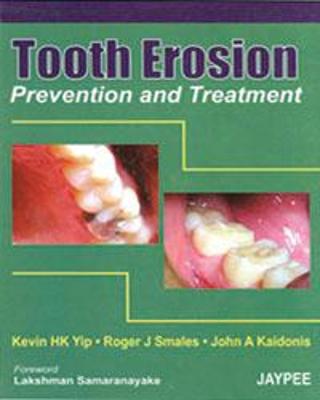 Tooth Erosion Prevention and Treatment