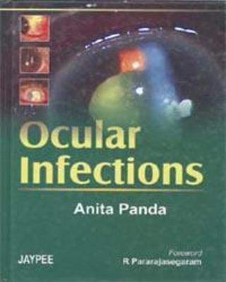 Ocular Infection
