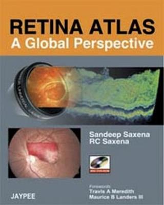 Retina Atlas - A Global Perspective