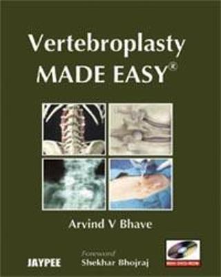 Vertebroplasty Made Easy