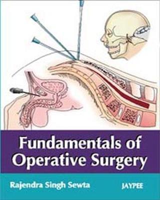 Fundamentals of Operative Surgery