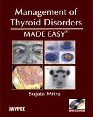 Management of Thyroid Disorders Made Easy