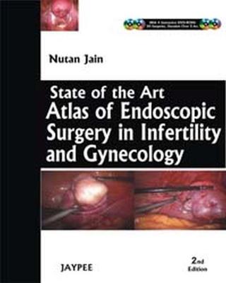 State-of-the-Art Atlas of Endoscopic Surgery in Infertility and Gynecology