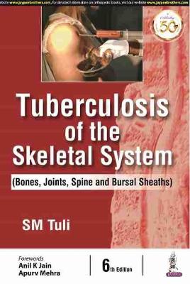 Tuberculosis of the Skeletal System