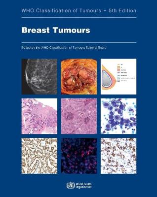 WHO Classification of Breast Tumours