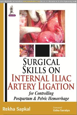 Surgical Skills on Internal Iliac Artery Ligation for Controlling Postpartum and Pelvic Hemorrhage