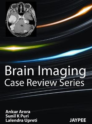 Brain Imaging