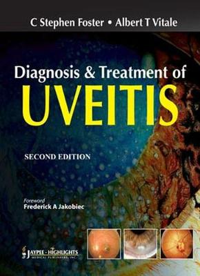 Diagnosis & Treatment of Uveitis