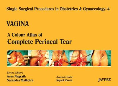 Single Surgical Procedures in Obstetrics and Gynaecology - Volume 4 - VAGINA