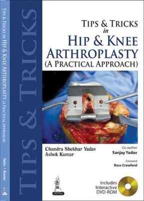 Tips and Tricks in Hip and Knee Arthroplasty