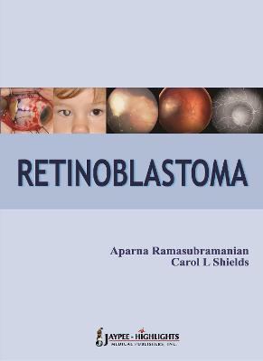 Retinoblastoma