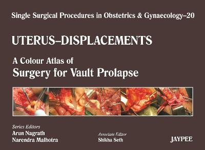 Single Surgical Procedures in Obstetrics and Gynaecology - Volume 20 - UTERUS - DISPLACEMENTS