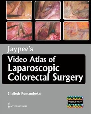 Jaypee's Video Atlas of Laparoscopic Colorectal Surgery