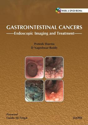 Gastrointestinal Cancers: