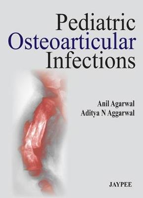 Pediatric Osteoarticular Infections