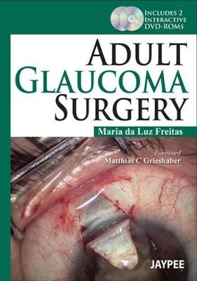 Adult Glaucoma Surgery