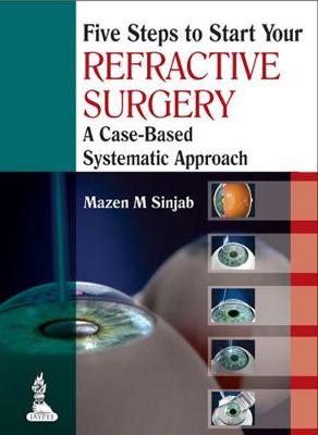 Five Steps to Start Your Refractive Surgery