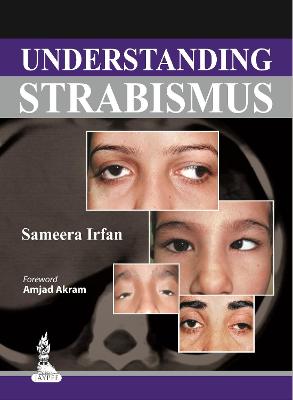 Understanding Strabismus