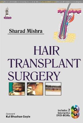 Hair Transplant Surgery